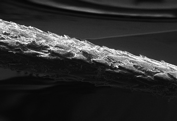 Figure 1. Magnified porcupine quill.
